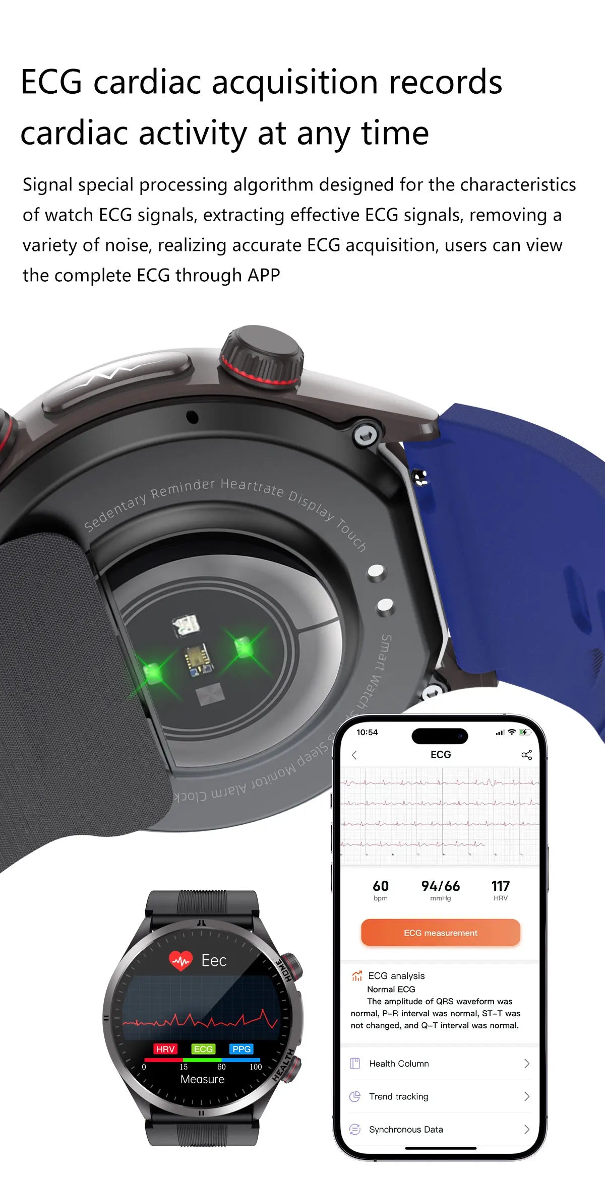 2026New Blood Pressure Air Pump Airbag Accurate Measure Smart Watch Men Micro Physical Examination Health ECG Smartwatch NFC BOX